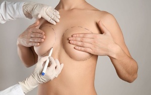 méthodes d'augmentation mammaire avec chirurgie