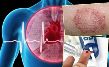 Contre-indications pour le lipolifting